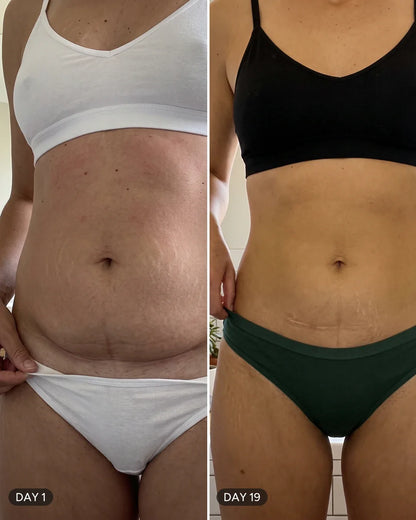 Before / After – Day 1 and Day 19